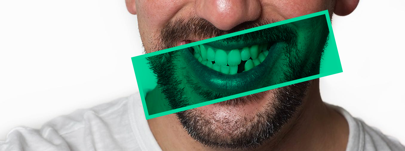 Edentulismo: La Importancia de los Implantes Dentales para una Sonrisa Completa